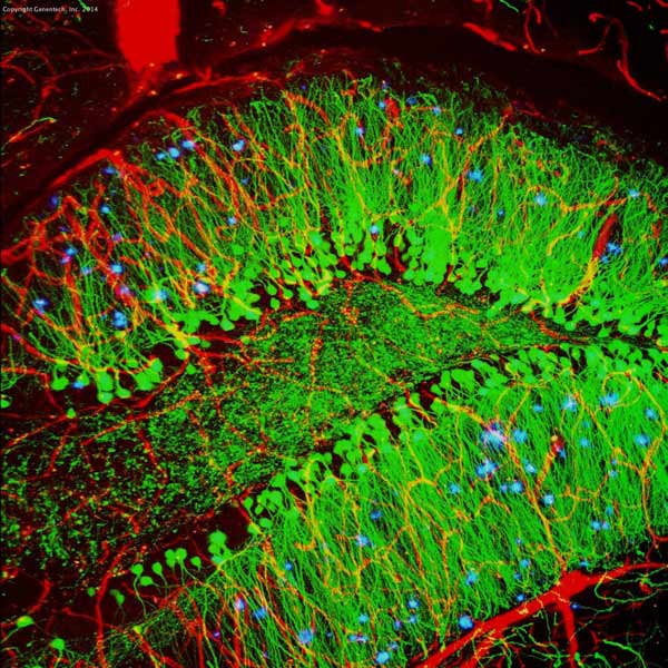 Image of a brain showing hallmarks of Alzheimer's disease (blue) by Alvin Gogineni, Genentech
